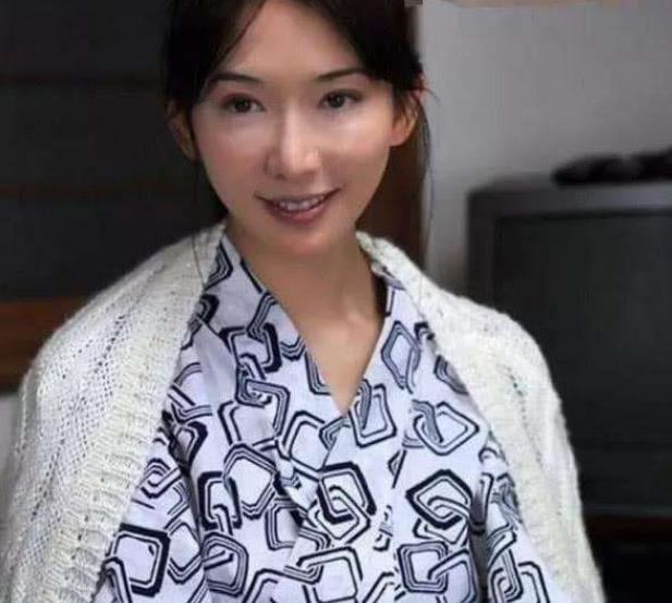 林志玲嫁到日本不到一年，膝盖骨上的淤青，网友看了表示很心疼-第3张图片-爱薇女性网