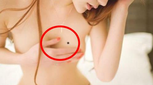 乳房上的痣图解，女人乳房上有痣代表什么