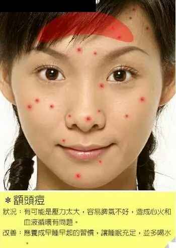 脸部各个部位长痘痘的原因示意图以及改善办法-第5张图片-爱薇女性网