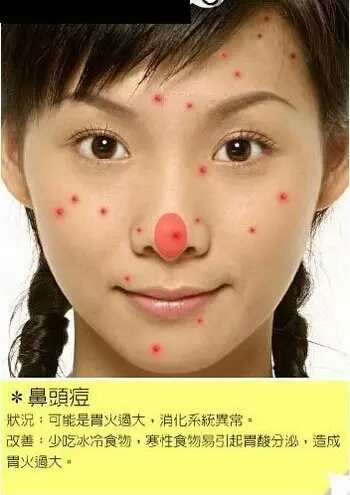 脸部各个部位长痘痘的原因示意图以及改善办法-第6张图片-爱薇女性网
